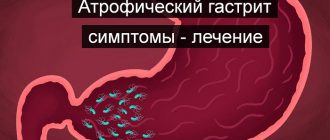 атрофический гастрит
